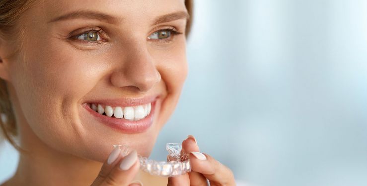 Jeune femme souriante montre un appareil orthodontique. Des gouttières orthodontiques transparentes.